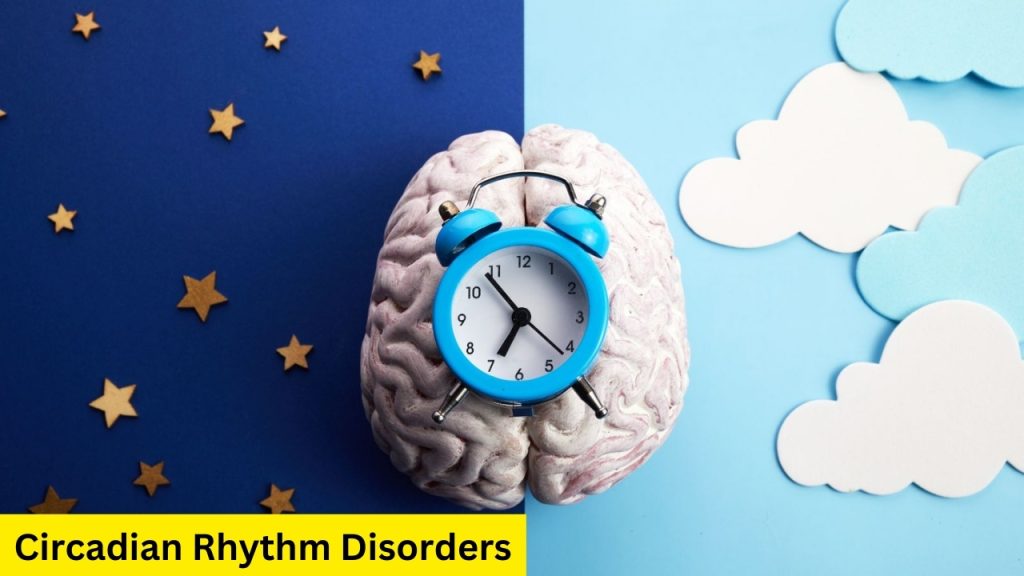 Circadian Rhythm Disorders