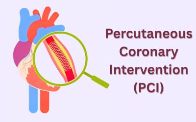 Percutaneous Coronary Intervention (PCI): Treatment & Procedure