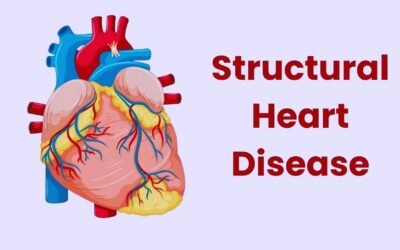 Structural Heart Disease: Causes, Symptoms, & Treatments