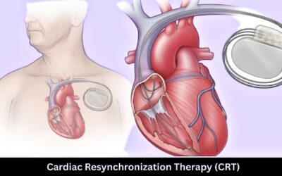 Cardiac Resynchronization Therapy (CRT): Definition, Benefits, and Procedure