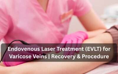 Endovenous Laser Treatment (EVLT)for Varicose Veins | Recovery & Procedure