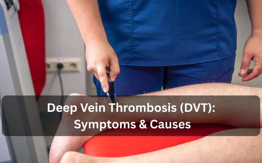 deep-vein-thrombosis-dvt-symptoms-causes