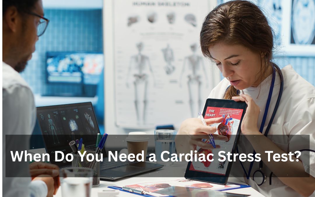 When Do You Need a Cardiac Stress Test?